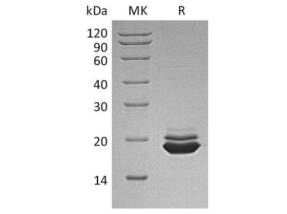 Human APLP Recombinant Protein (RPES4624)