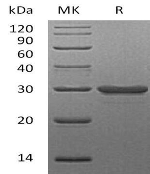 Human Galectin-3/LGALS3 Recombinant Protein  (RPES4654)