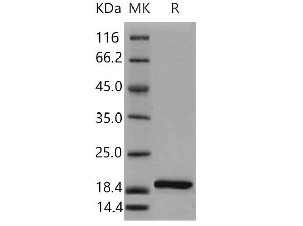 Mouse IL beta/IL1B Recombinant Protein  (RPES4658)