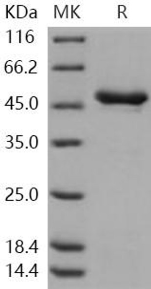 TPH1 Recombinant Protein (RPES4666)