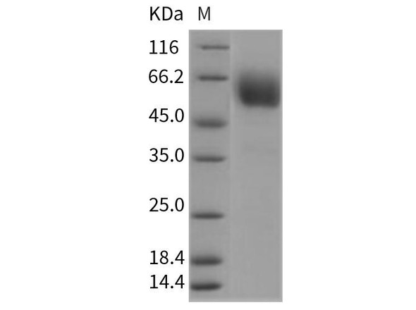 Rat CD47 Recombinant Protein (RPES4669)