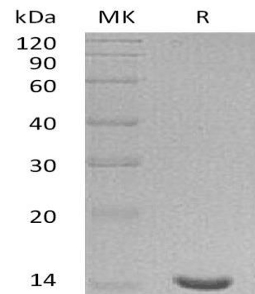 Human Galectin-7/LGALS7 Recombinant Protein  (RPES4675)