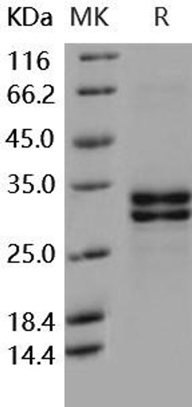 Human HMGB1/HMG1 Recombinant Protein (RPES4694)