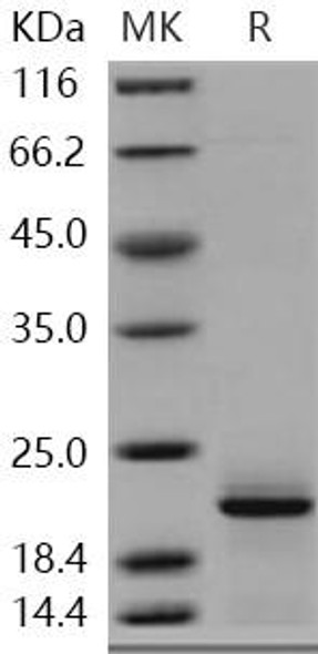 Human Complexin-2/CPLX2 Recombinant Protein (RPES4707)