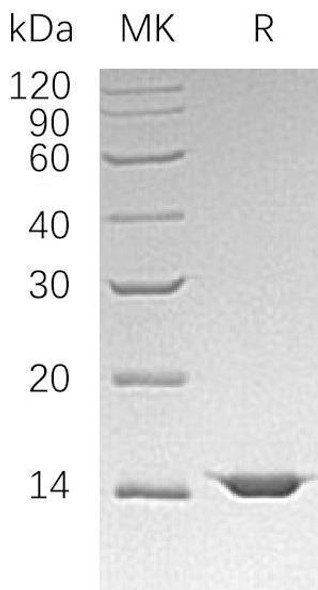 Human FIS1 Recombinant Protein (RPES4717)