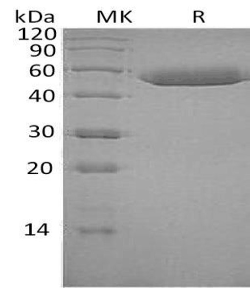 Human SerpinF1/PEDF Recombinant Protein (RPES4718)