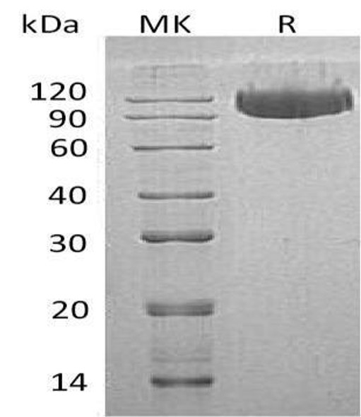 Human SerpinG1/C1IN Recombinant Protein (RPES4741)