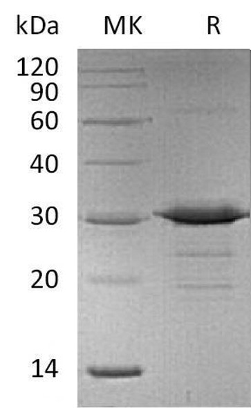 Mouse Adiponectin/AdipoQ Recombinant Protein (RPES4743)