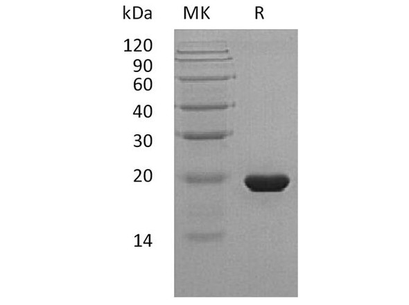 Sonic Hedgehog/SHH Recombinant Protein (C24II) (RPES4749)