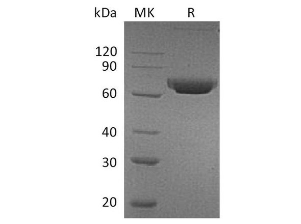 Human CD157/BST1 Recombinant Protein (RPES4750)