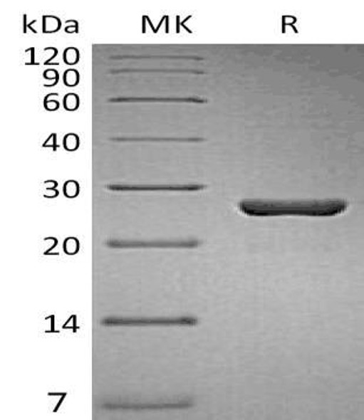 Human Gankyrin/PSDM10 Recombinant Protein (RPES4761)