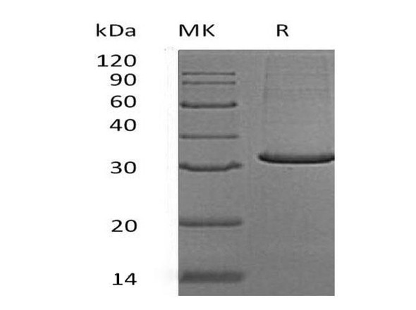 Human MOB4/MOBKL3 Recombinant Protein (RPES4762)