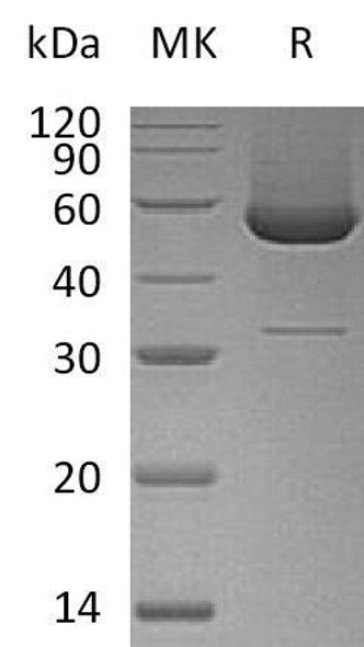Human SerpinH1/SERPINH1 Recombinant Protein (RPES4763)