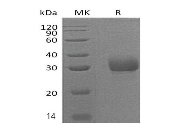 Mouse Adiponectin/AdipoQ Recombinant Protein (RPES4765)