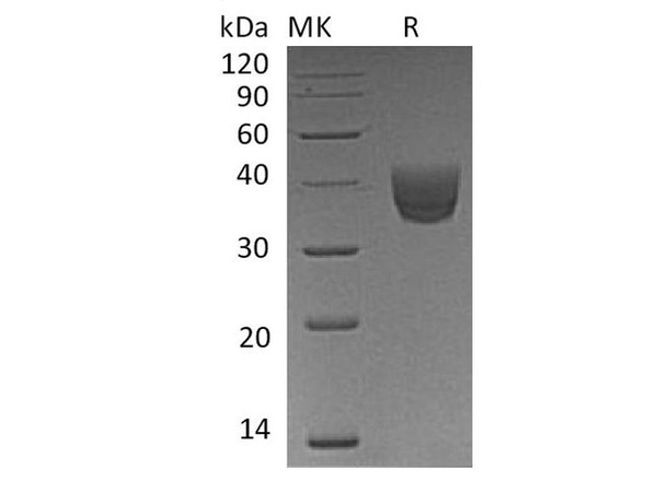 Human CD157/BST1 Recombinant Protein (RPES4772)