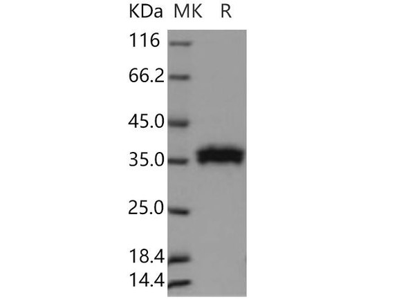 Human RNASET2 Recombinant Protein (RPES4773)