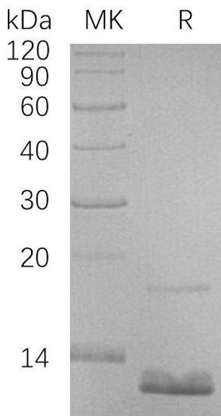 Human CCL18 Recombinant Protein (RPES4782)