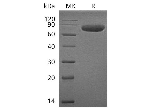 Human CD38 Recombinant Protein (RPES4793)