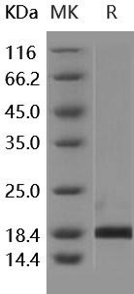 Human PIN1/Rotamase Pin1 Recombinant Protein (RPES4802)