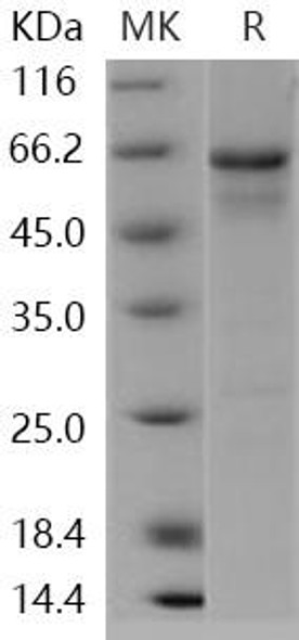 Human ERN1/IRE1 Recombinant Protein (RPES4816)