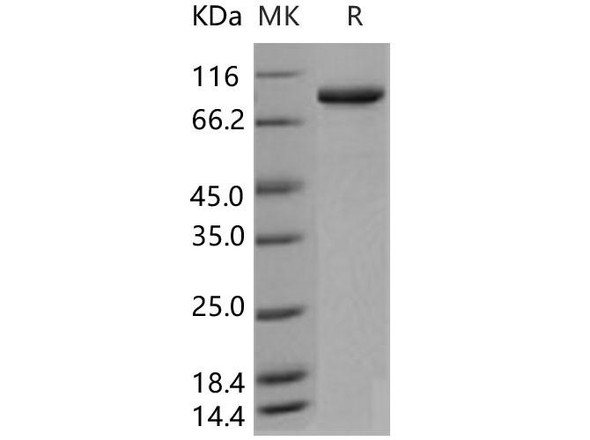 Human ACO1/irp1 Recombinant Protein (RPES4817)