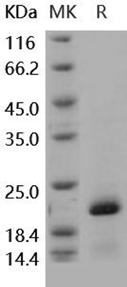 Human PIN1/Rotamase Pin1 Recombinant Protein (RPES4818)