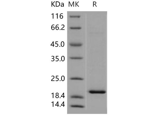 Human TSC22D1 Recombinant Protein (RPES4821)