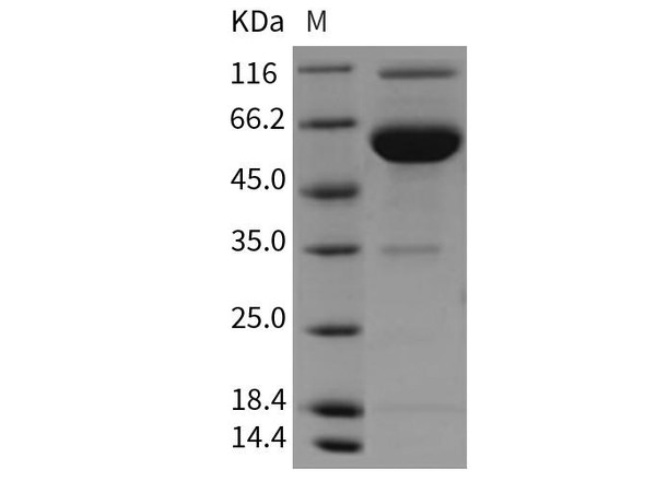 Rat ESAM Recombinant Protein (RPES4827)