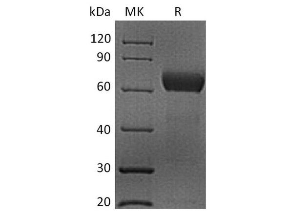 Human CD48 Recombinant Protein (RPES4833)