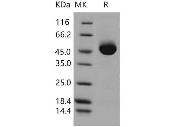 ACPP Recombinant Protein (RPES4836)
