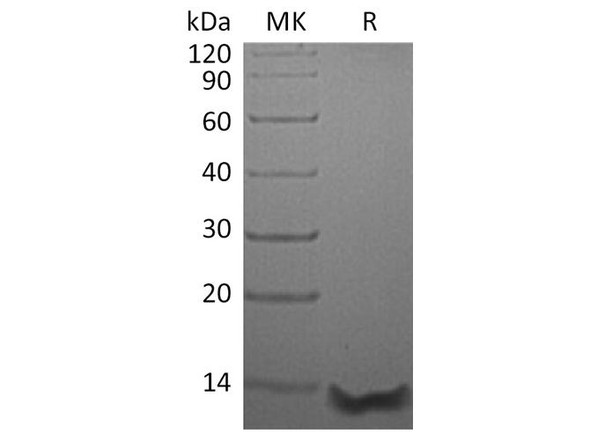 Human Eotaxin-3/CCL26 Recombinant Protein (RPES4843)