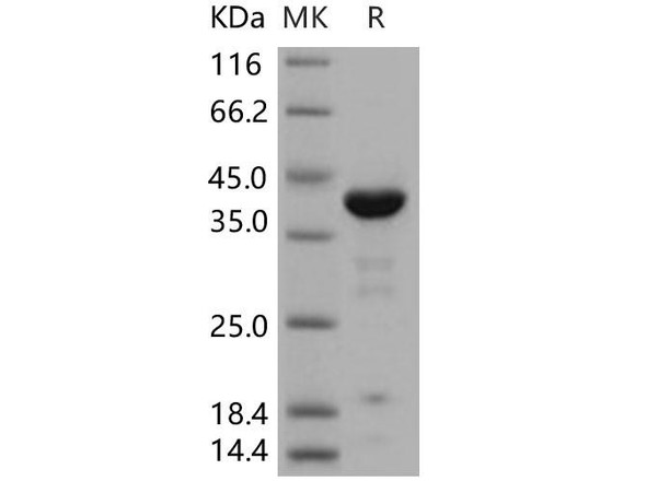 Human ACP1/LMW-PTP Recombinant Protein (RPES4857)