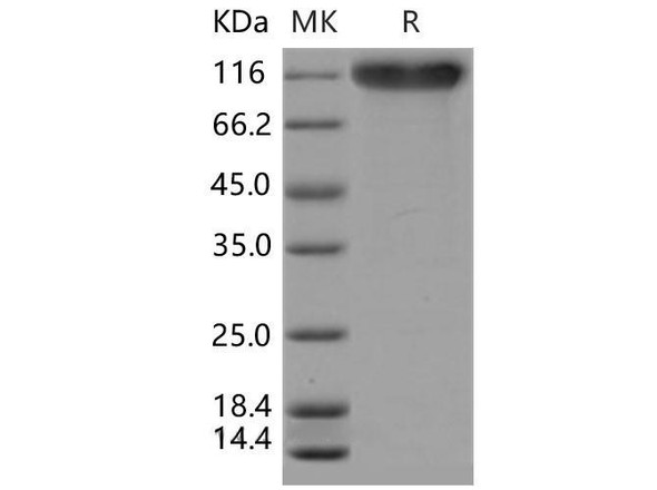 Mouse P-selectin Recombinant Protein (RPES4860)