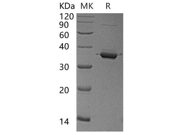 Human GGPS1 Recombinant Protein (RPES4865)