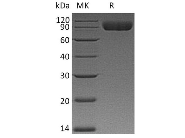 Human CD172a/SIRPA Recombinant Protein (RPES4874)