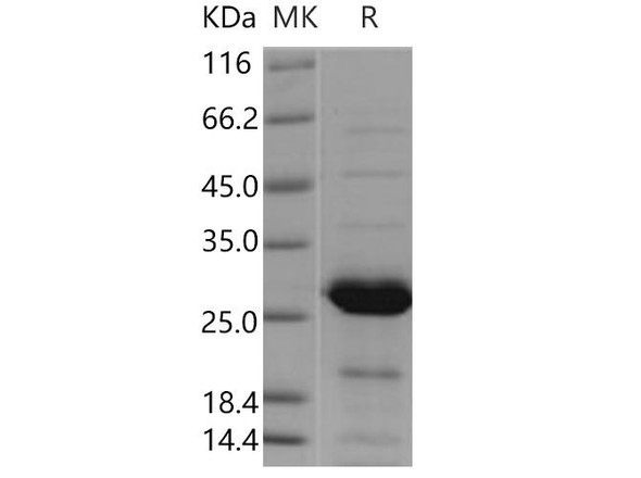 Human PSPH Recombinant Protein (RPES4876)