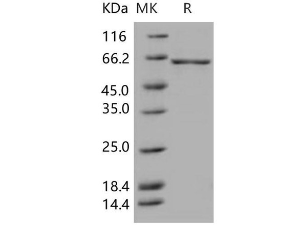 Human GAD67/GAD1 Recombinant Protein (RPES4882)