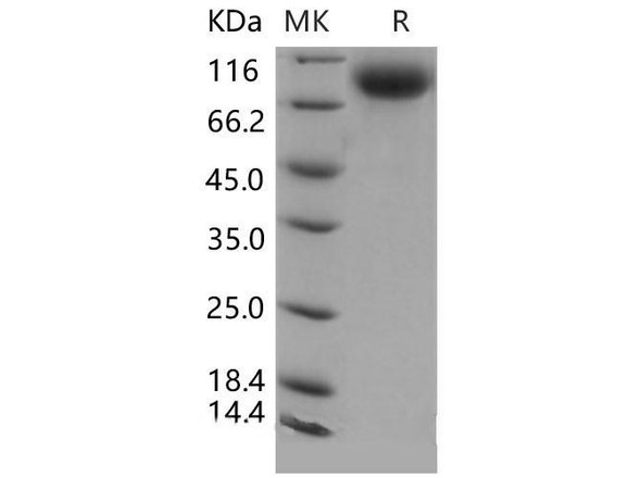 Mouse E-Selectin/SELE Recombinant Protein (RPES4900)