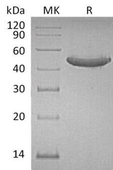 Human GITR/TNFRSF18 Recombinant Protein (RPES4904)