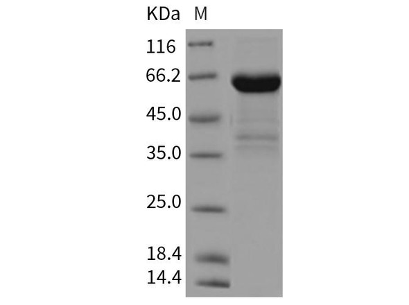 Rat CD23 Recombinant Protein (RPES4907)