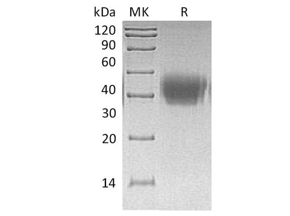 Human Activin RIIA/ACVR2A Recombinant Protein (RPES4914)