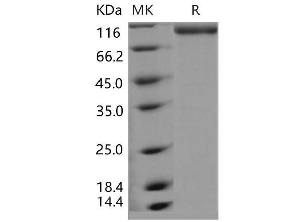 Mouse E-Selectin/SELE Recombinant Protein (RPES4920)