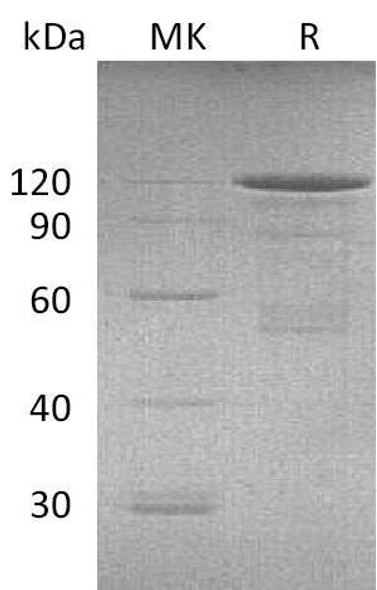 Mouse Cadherin-3/CDH3 Recombinant Protein (RPES4929)