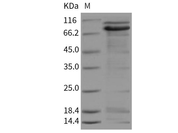Rat E-Cadherin/CDH1 Recombinant Protein (RPES4939)