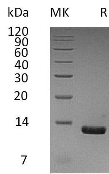 Human CCL8/MCP-2 Recombinant Protein (RPES4944)