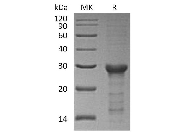Human STAT6 Recombinant Protein (RPES4954)