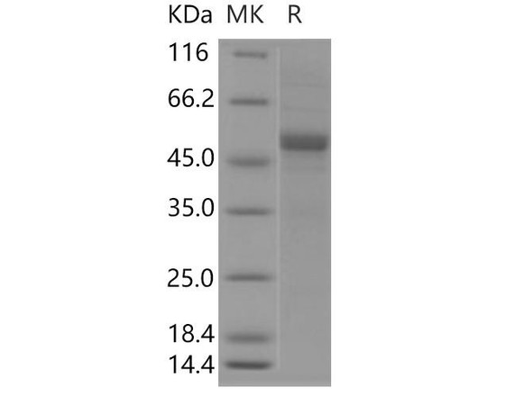 Human APOM Recombinant Protein (RPES4977)