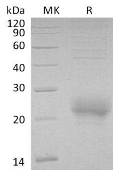 Human CD160/BY55 Recombinant Protein (RPES4986)