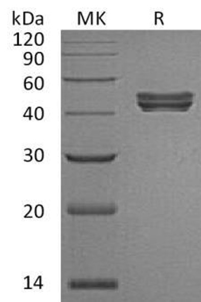 Human Sialidase/NEU Recombinant Protein (RPES4989)