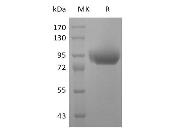 Human SIGLEC5 Recombinant Protein (RPES4996)